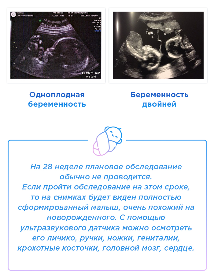 32 неделя беременности размеры