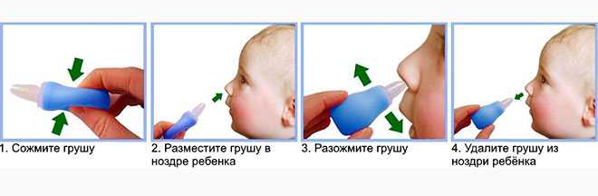 Можно ли отсосать сопли. Доставать сопли из носа новорожденного. Прочистить ребенку нос новорожденному. Откачивание соплей у грудничка. Правильно отсасывать сопли у грудничка.
