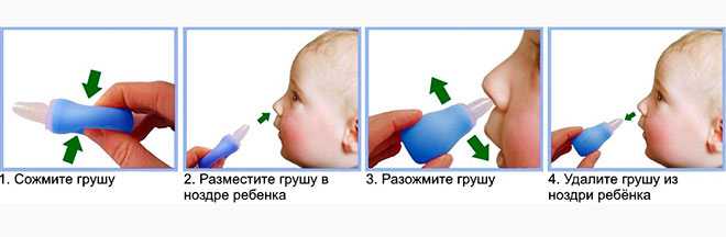 Как убрать сопли без аспиратора. Доставать сопли из носа новорожденного. Откачивание соплей у грудничка. Правильно отсасывать сопли у грудничка. Груша для очистки носа новорожденного.