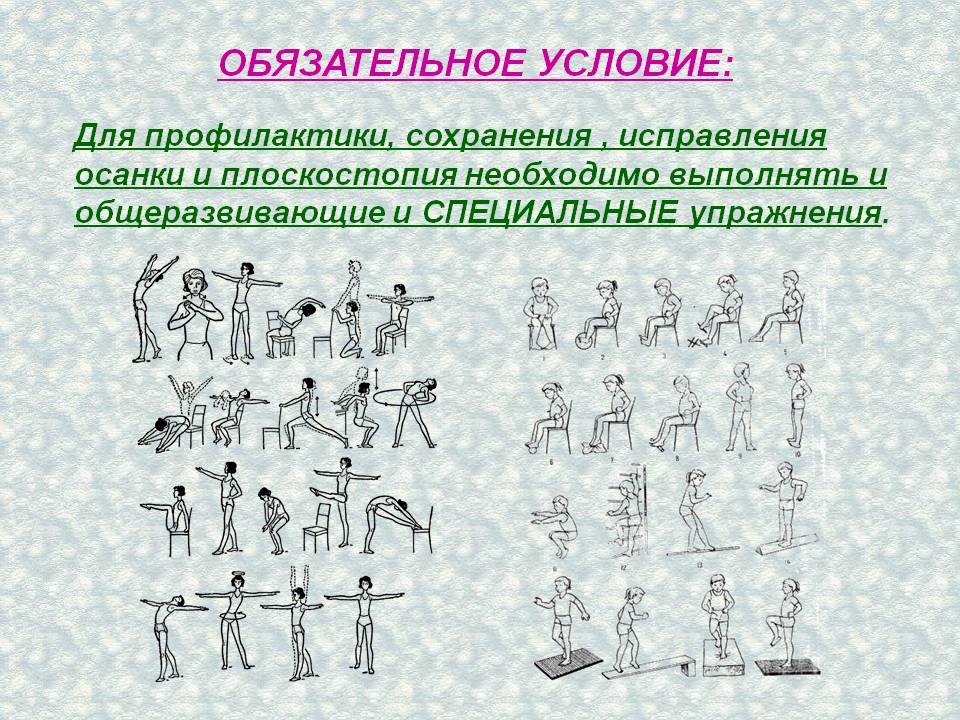 Комплекс выполнен. Комплекс упражнений для коррекции нарушений осанки. Общеразвивающие упражнения для правильной осанки. Общеразвивающие упражнения на осанку. Упражнения для профилактики нарушения плоскостопия.