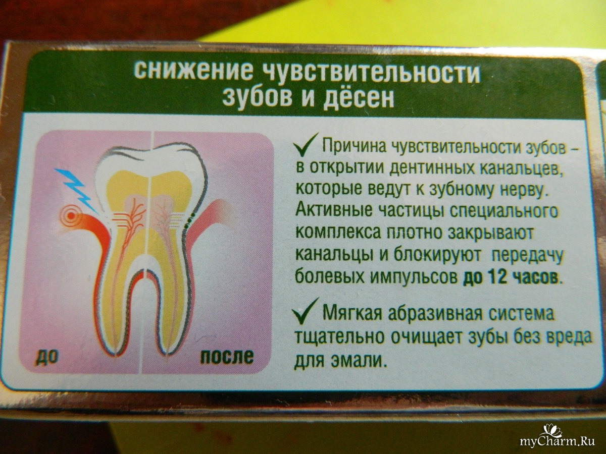 Сильная чувствительность зубов. Уменьшение чувствительности зубов. Причины повышенной чувствительности зубов. Снизить чувствительность зубов.